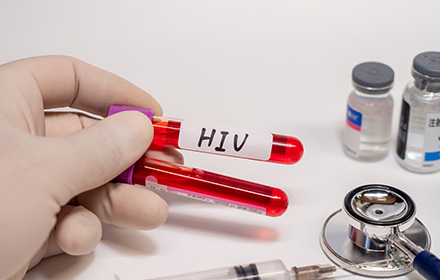 HIV Positive Blood Sample Representing the Importance of Disclosing HIV Status
